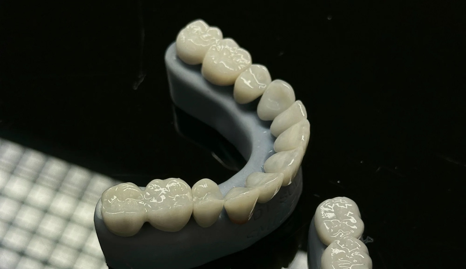 Coronas y un puente terminados sobre un modelo dental impreso en 3D en el laboratorio de Dent Lab