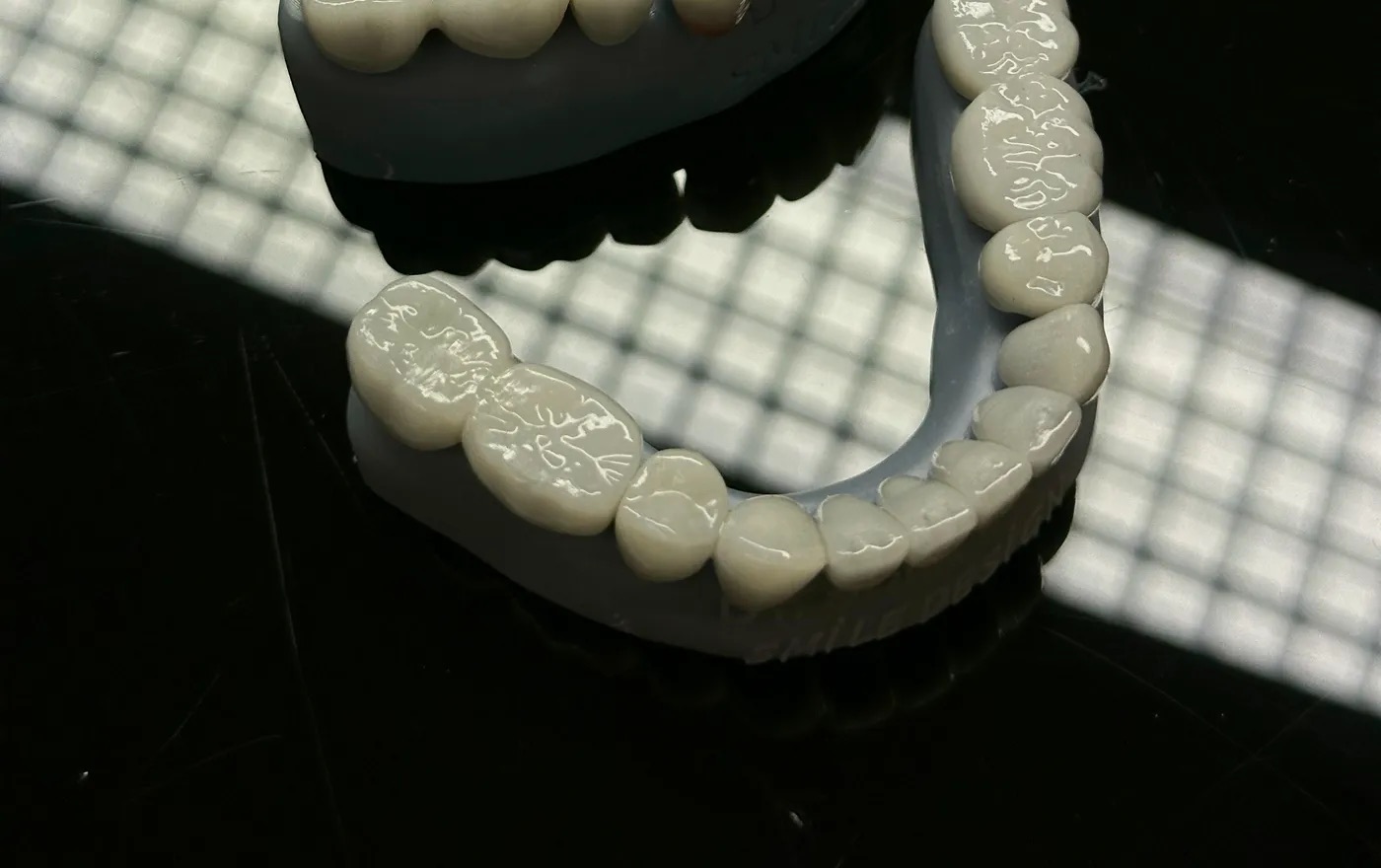 Restauraciones terminadas colocadas sobre modelos de trabajo impresos en 3D en el laboratorio de Dent Lab